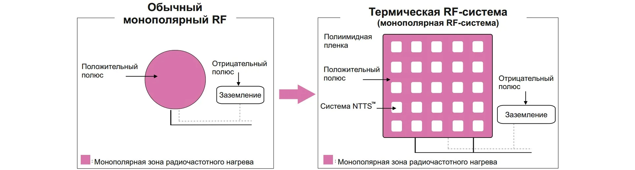 Две RF-технологии в одном аппарате