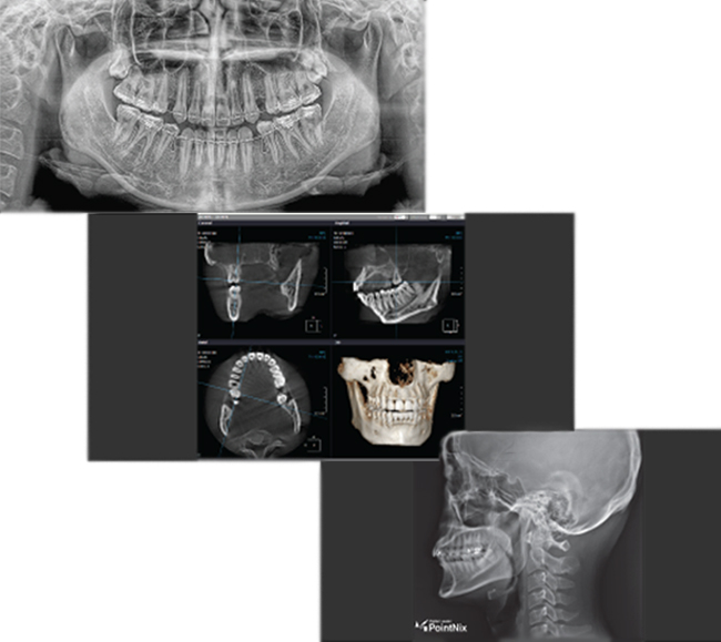 Point 3D Combi 500 C