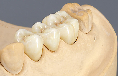 Мосты