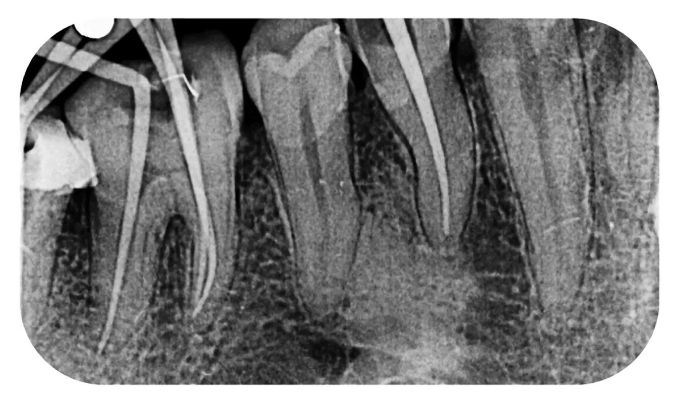 Высокая разрешающая способность