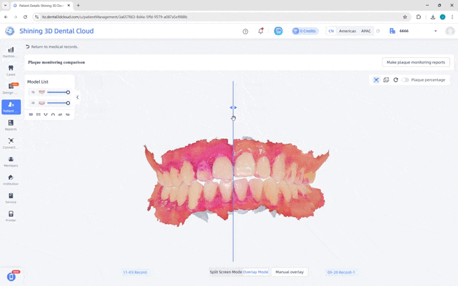 Smart Report Comparison