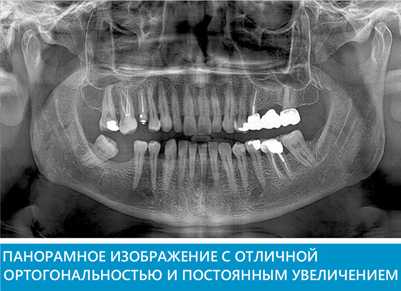 wfpmp4731fwdb28k8bonwejzjaswmvlu.jpg