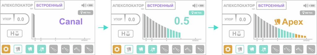 Апекслокатор 