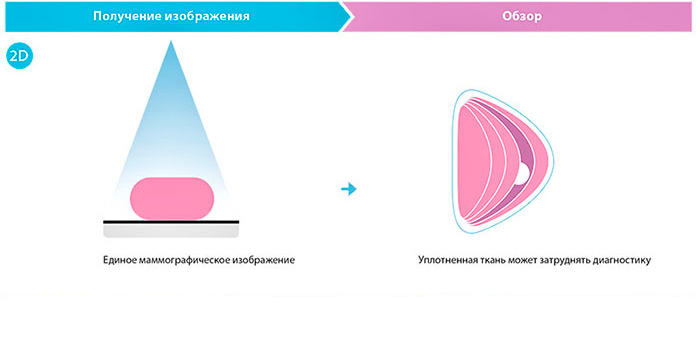 Система MaxView