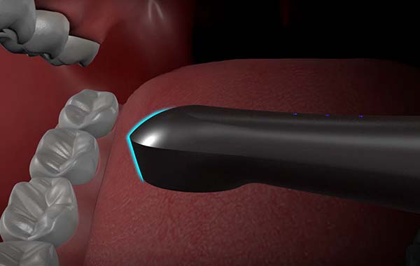 Тонкая конструкция