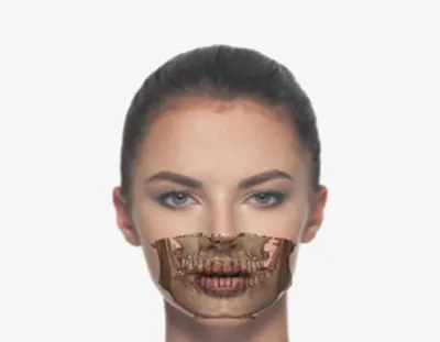 fov_1.webp
