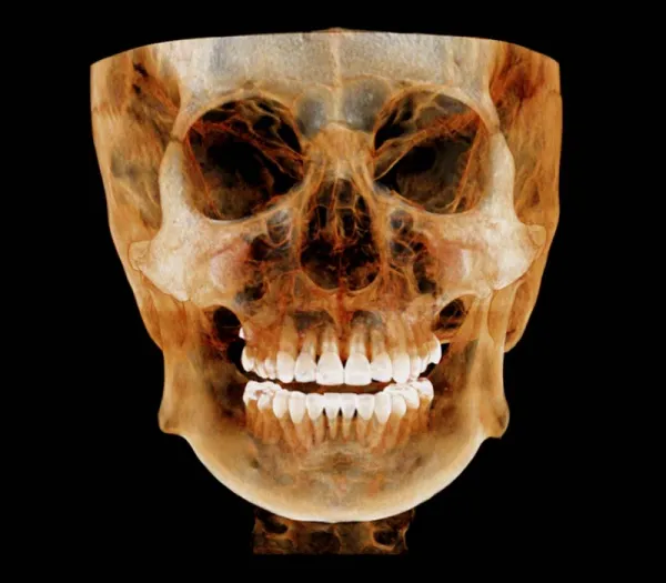gh-01.webp