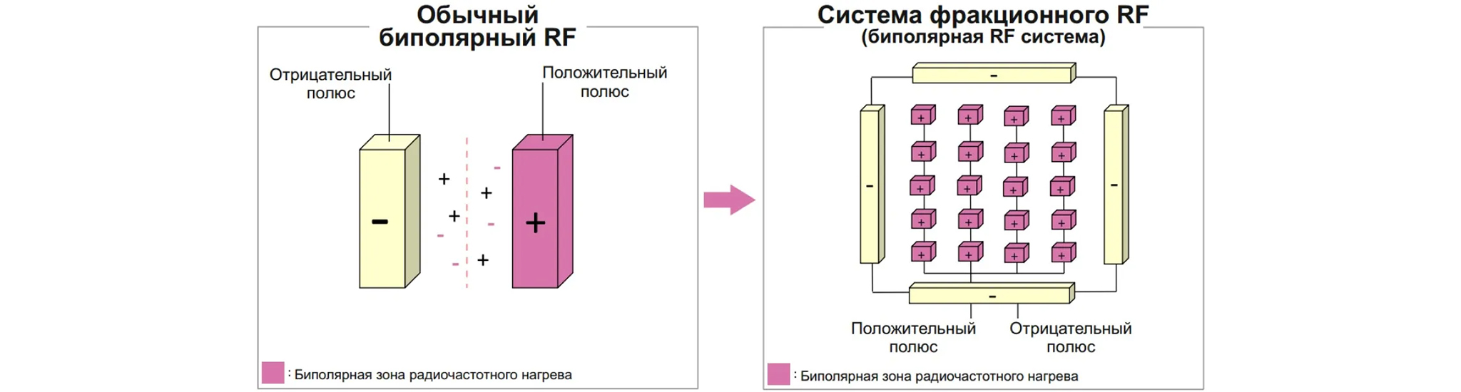 Принципиальное отличие