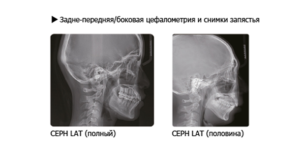 CEPH LAT