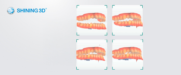 Shining3D MetiSmile