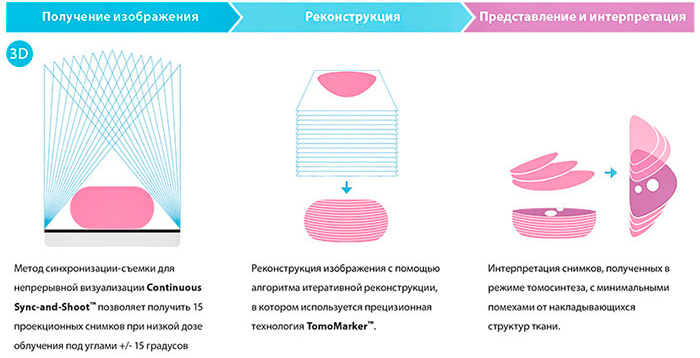 Система MaxView