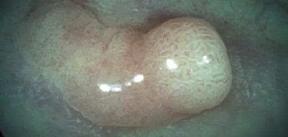 Усиление тонов