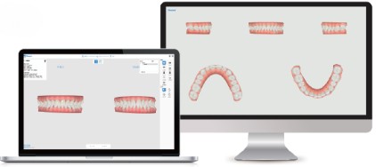 Ортодонтическое моделирование