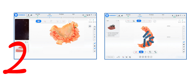 Внутриротовое сканирование