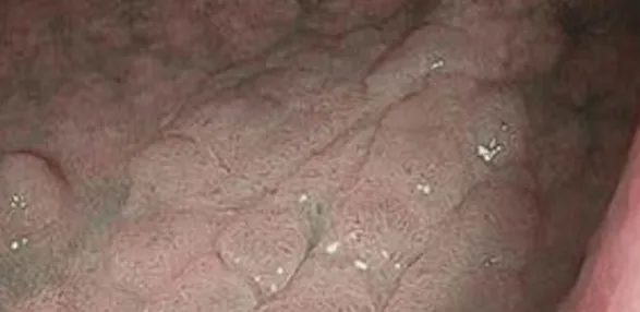 Оптическое улучшение режим 2