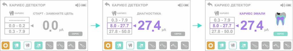 Кариес детектор