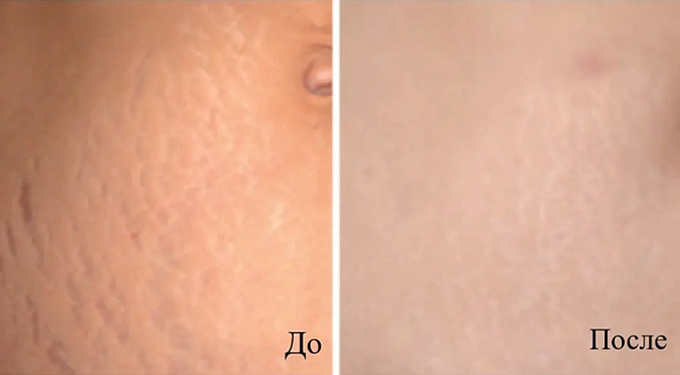 Область применения
