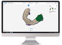 Повышенная чёткость в придесневой области