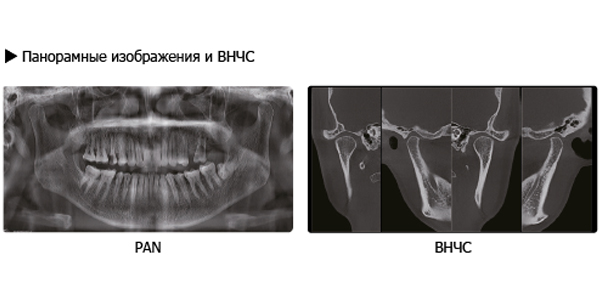 ВНЧС