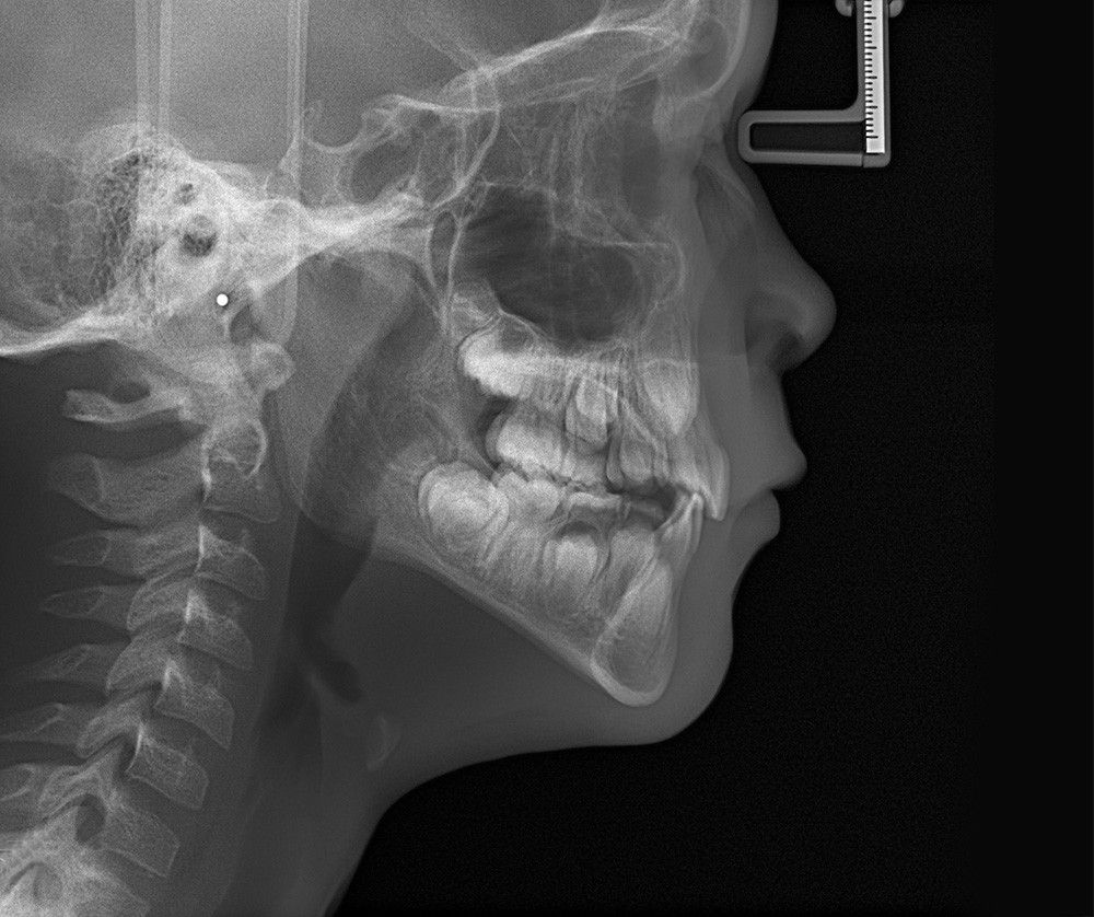 OP-3D_X-ray_LAT-PED-head2_1000px.jpeg