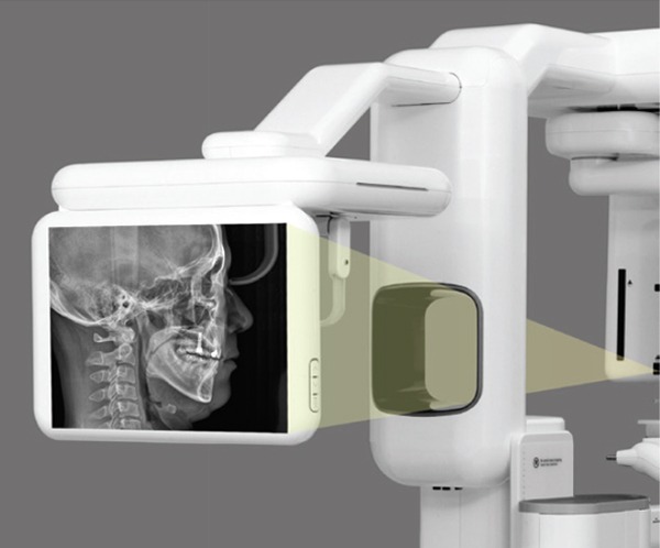 Цефалостат – аппарат для стоматологического кабинета